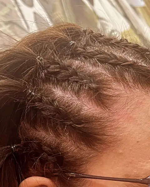 Detalle de unas trenzas pegadas en la parte delantera de la cabeza